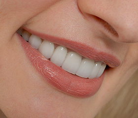 Closeup of health smile