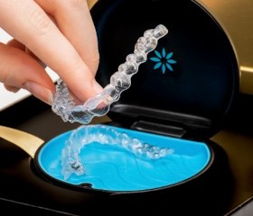 Aligners for Invisalign in Port Orange in case