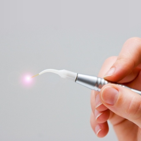 Hand holding a soft tissue laser