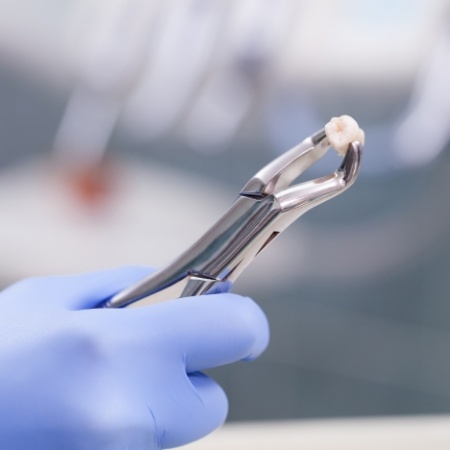 Gloved hand holding a tooth in forceps